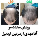 تونیک اورجینال اصل کاهش ریزش مو و محرک سرعت رشد مو تقویت کننده مو ۳۰۰ میل ارسال مستقیم از شرکت ایرانیان زمین