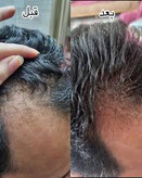 خرید عمده 20عددی تونیک رشد مو اصل تضمینی ۳۰۰ میل ارسال مستقیم از شرکت ایرانیان زمین