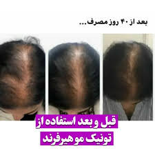 خرید عمده 20عددی تونیک رشد مو اصل تضمینی ۳۰۰ میل ارسال مستقیم از شرکت ایرانیان زمین