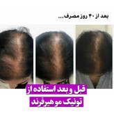 خرید عمده 20عددی تونیک کاهش ریزش مو و رشد مجدد مو کاملا اصل تضمینی ۳۰۰ میل ارسال مستقیم از شرکت ایرانیان زمین