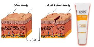کرم رفع ترک های پوستی ناشی از بارداری گاتیو ایتالیا 100 میل