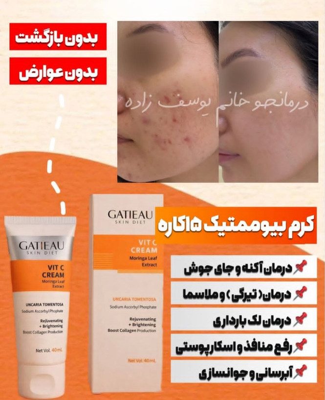 کرم بیوممتیک ضد لک جهانی جوانساز روشن کننده گاتیو ایتالیا12کاره