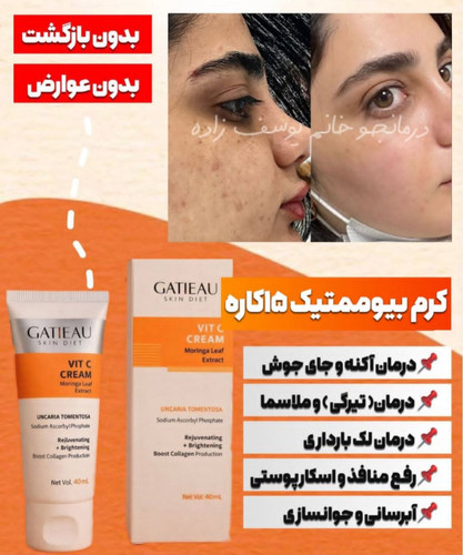 کرم بیوممتیک ضد لک جهانی و روشن کننده کهنده منافذ گاتیو ایتالیا