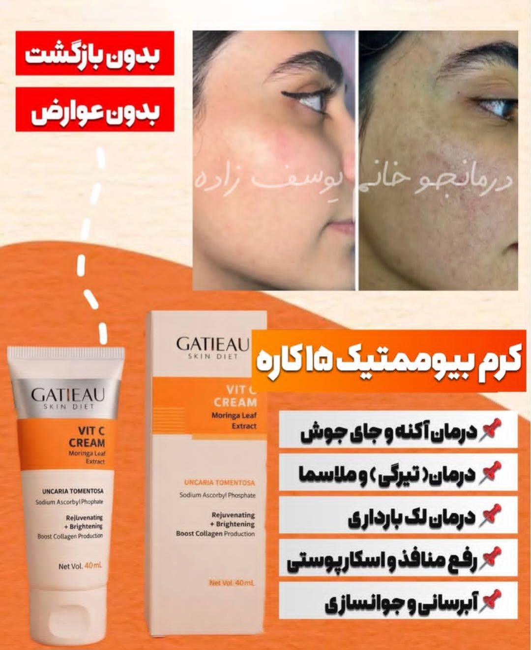 کرم شفاف کننده بیوممتیک جوانساز تضمینی و ضد چروک گاتیو ایتالیا ویتامین سی ۴۰ میل ارسالی مستقیم از نمایندگی