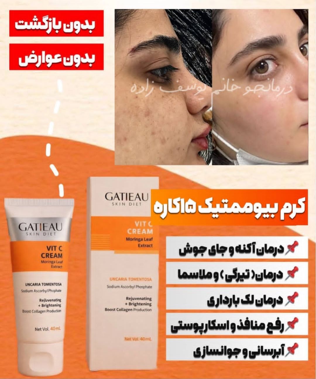 کرم ۵ کاره اورجینال جوانساز و ترمیم کننده پوست ومحرک قوی پوست برای سنتز کلاژن و ضد لک و اکنه و شفاف کننده گاتیو ایتالیا- ویتامین سی ۴۰ میل